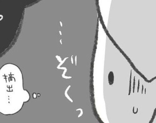「卵巣摘出！？」強烈な痛みの原因は？医師の言葉に震えた／卵巣のう腫が消えた#8